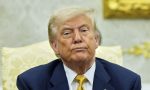 trumpa-kronik-venoz-yetmezlik-teshisi-konuldu-PzGbucRR.jpg