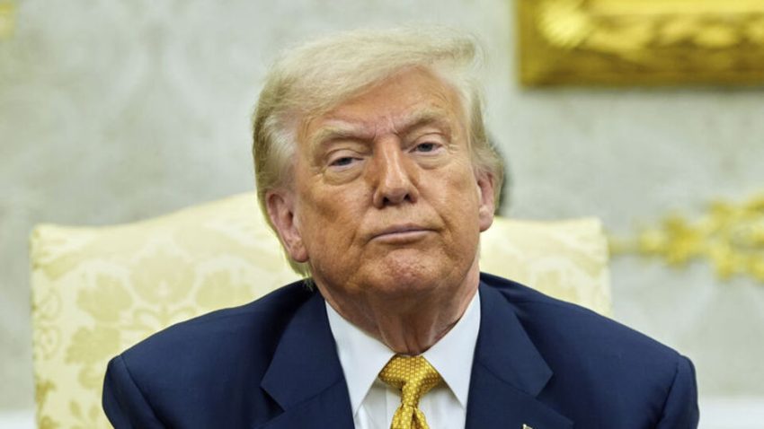 Trump’a “kronik venöz yetmezlik” teşhisi konuldu
